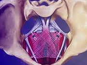 MyPassion